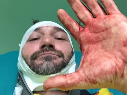 Lo spray urticante, poi le sprangate: la furia dei tre banditi stranieri
