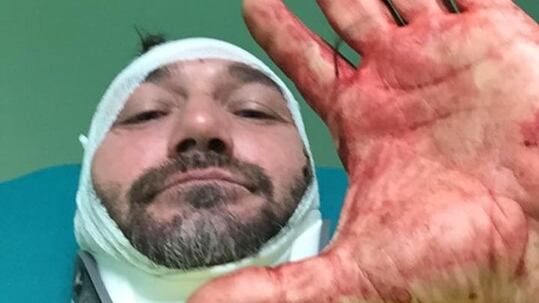 Lo spray urticante, poi le sprangate: la furia dei tre banditi stranieri