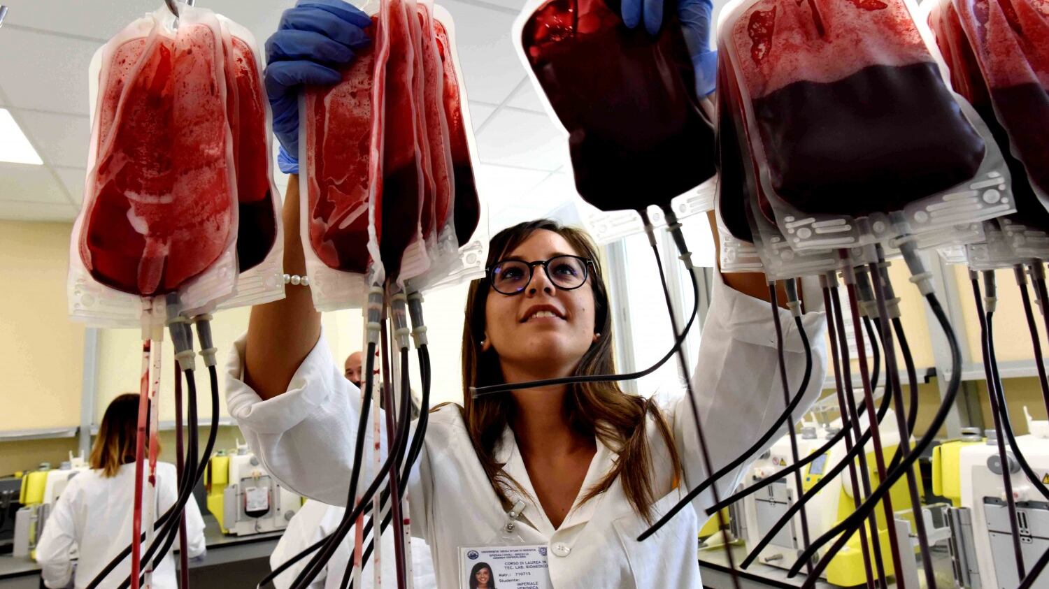 Preso l'untore dell'Hiv: sono a rischio 228 donne