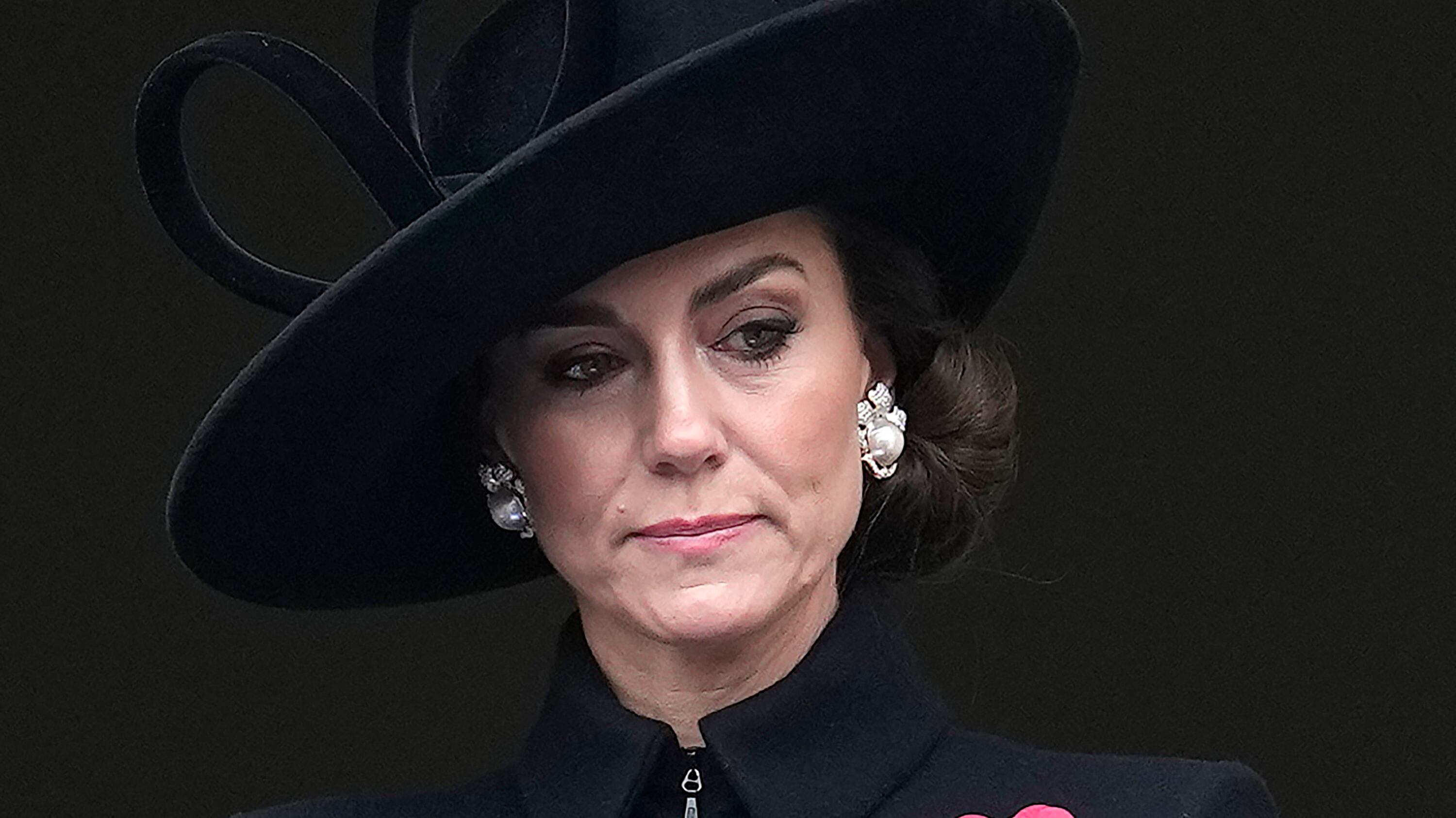 I polipi, i diverticoli, il tumore. Le ipotesi del chirurgo sull'intervento di Kate
