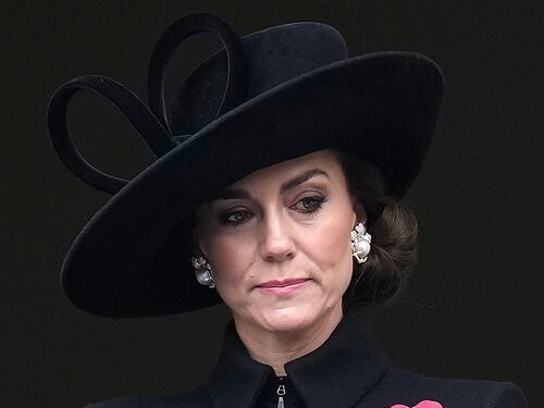 I polipi, i diverticoli, il tumore. Le ipotesi del chirurgo sull'intervento di Kate