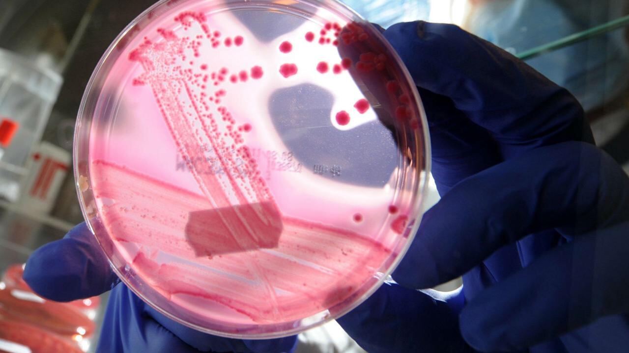 Resistenza agli antibiotici, nuova arma contro i batteri: ecco come eludono l'azione dei medicinali