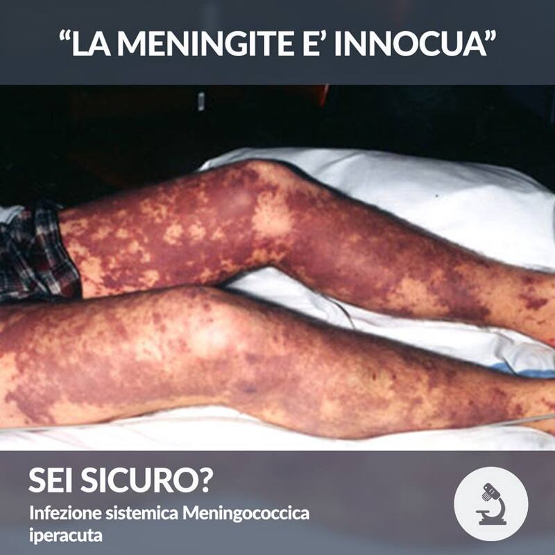 Vaccini, le foto choc: cosa succede a chi non si vaccina 8