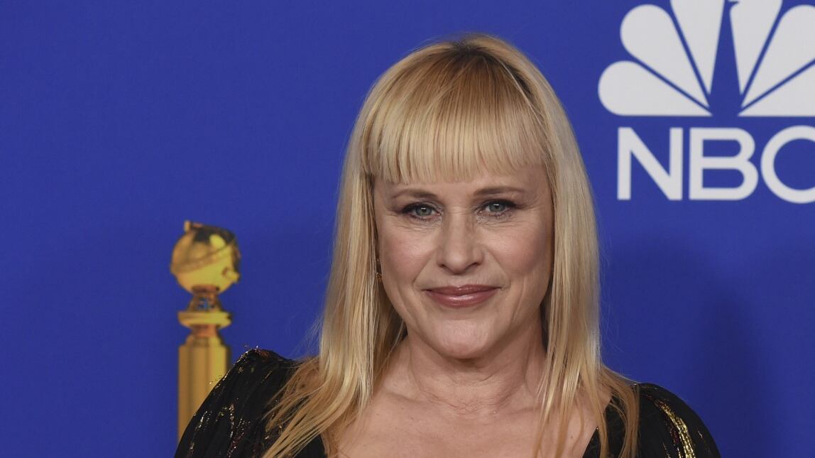 Severance, Patricia Arquette nella nuova serie tv Apple