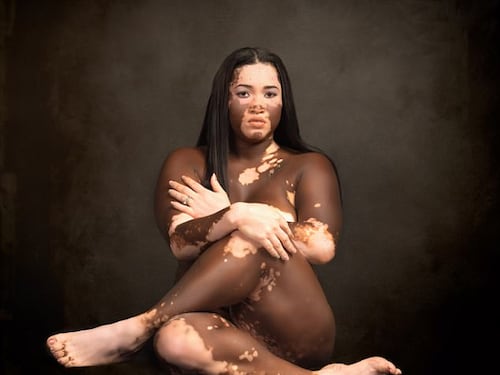 Iomikoe, la modella nera che vuole diventare bianca