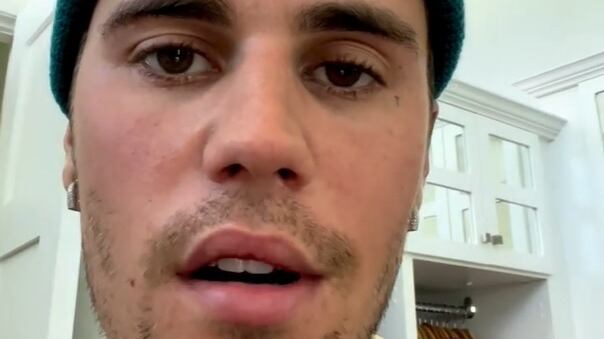 Justin Bieber choc: "Un virus mi ha paralizzato metà faccia. Non so quando tornerò sul palco"