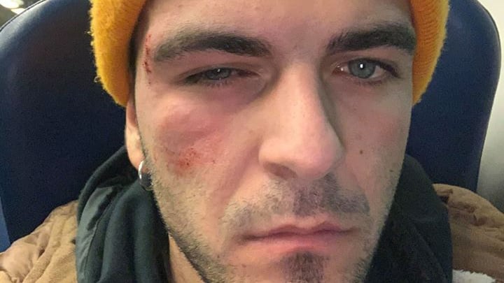 Nordafricani pestano a sangue commesso per una cartina di sigaretta