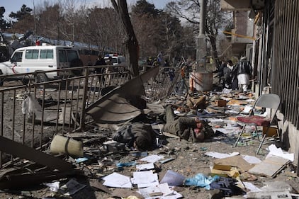 I feriti nell'attentato di Kabul 17