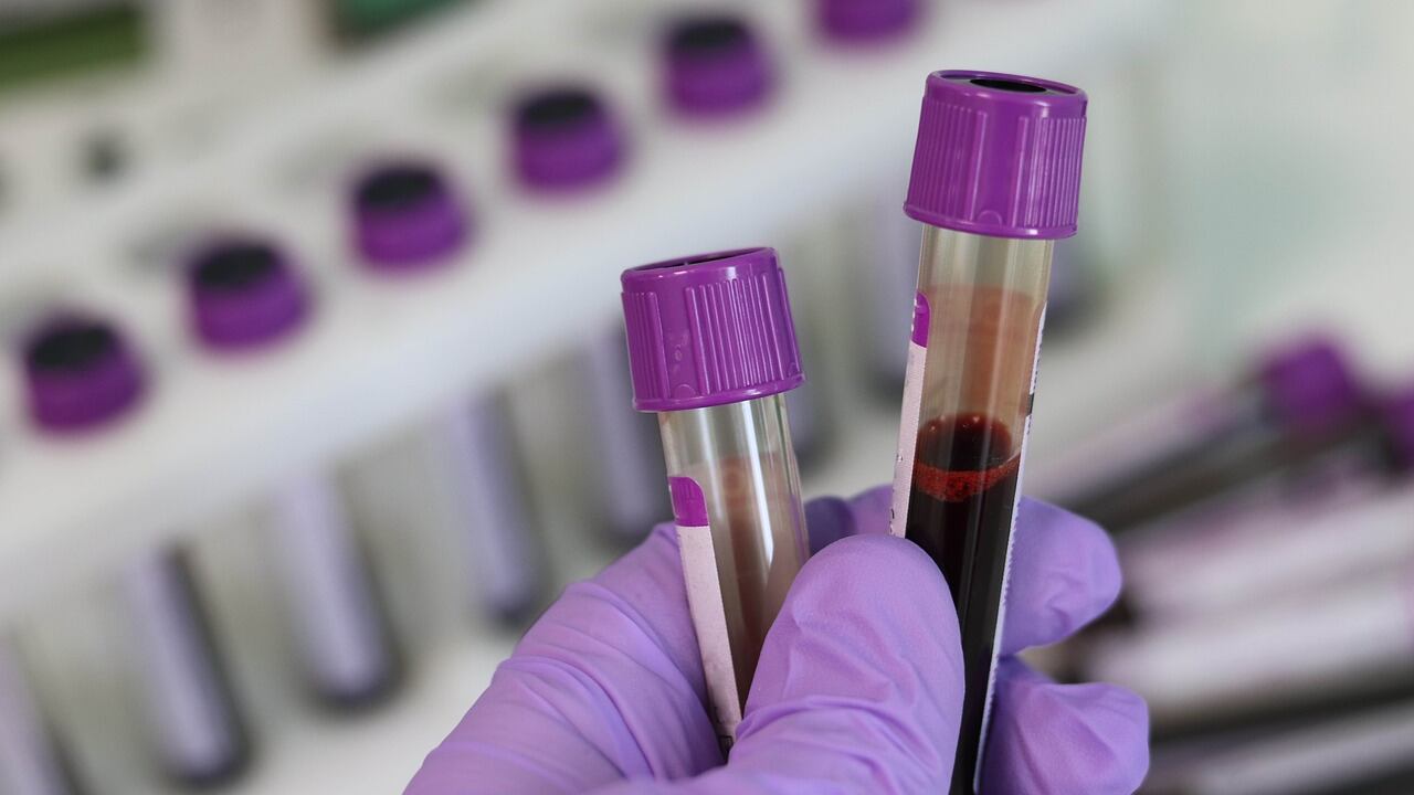 Allarme microplastiche nel sangue: ecco la scoperta