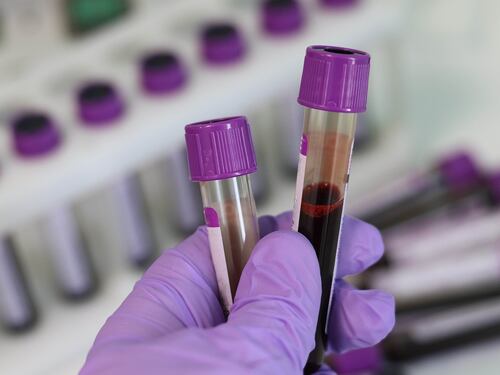 "Meglio il sangue dei non vaccinati": delirio no vax contro le donazioni