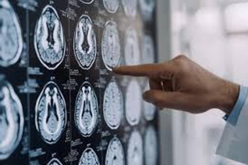 Morbo di Parkinson, cos’è e quali sono i sintomi