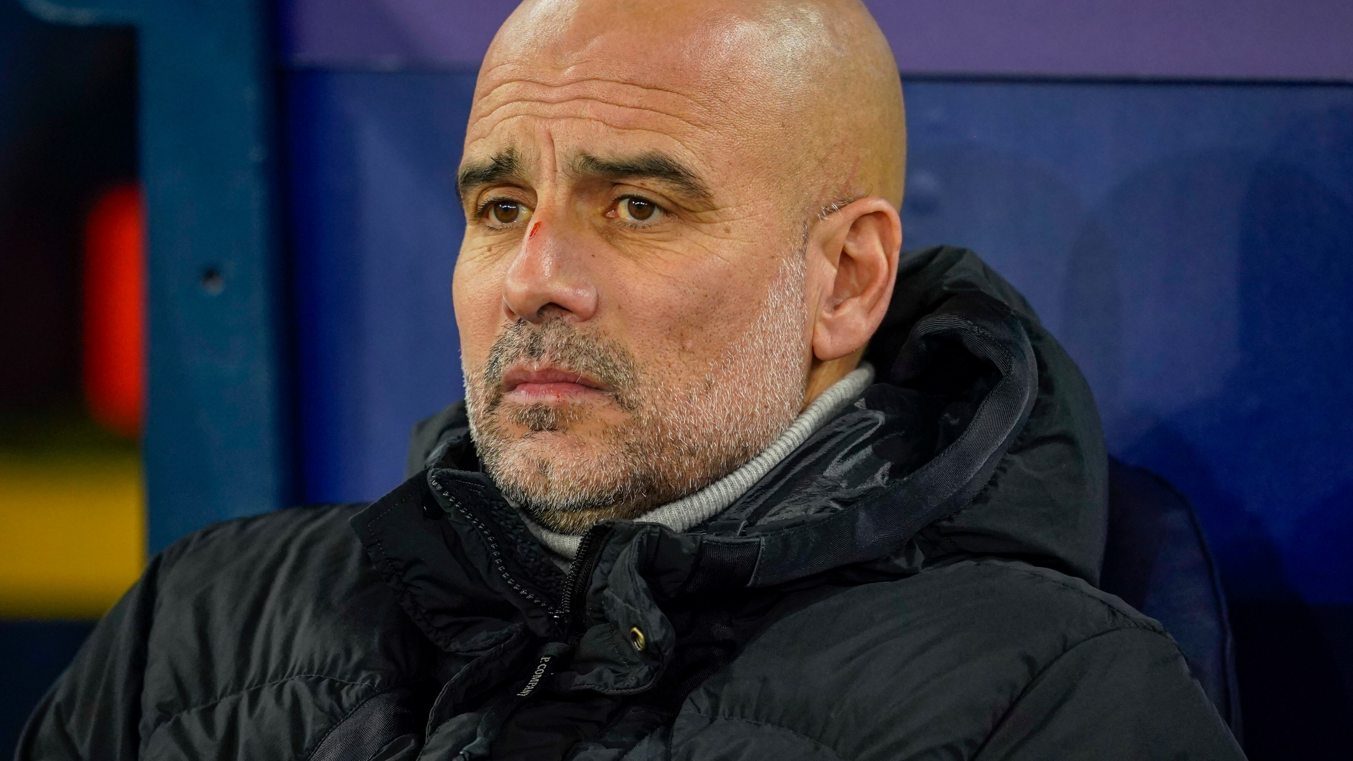 Quei graffi sul volto di Guardiola e l'allarme per la sua tensione nervosa