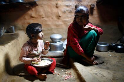 Nepal, soffrono di una malattia che li rende pelosissimi 14