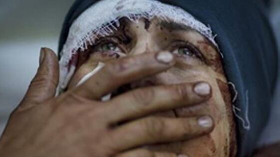 Siria, una preghiera per la pace