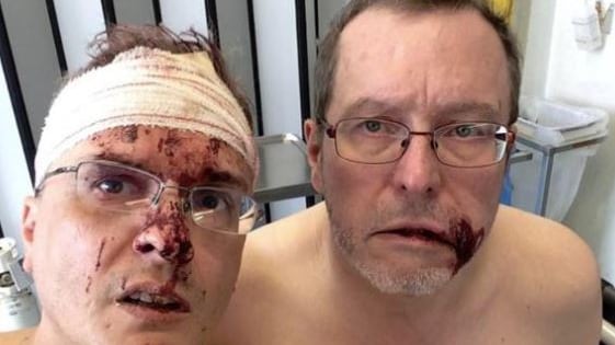 Belgio, denuncia di un italiano: "Noi picchiati perché siamo gay"