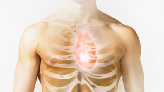 L'infarto è ancora la prima causa di morte Occhio all'obesità: è il vero nemico