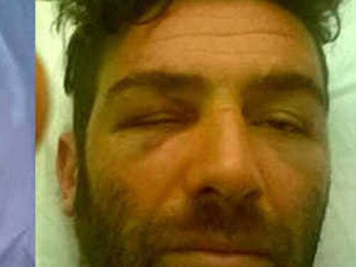 Titolari osteria massacrati da un gruppo di stranieri