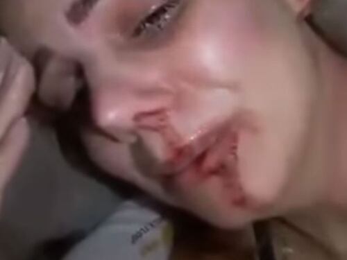Renata Lustosa massacrata di botte dall'ex: "Cosa faccio con un mostro così?"