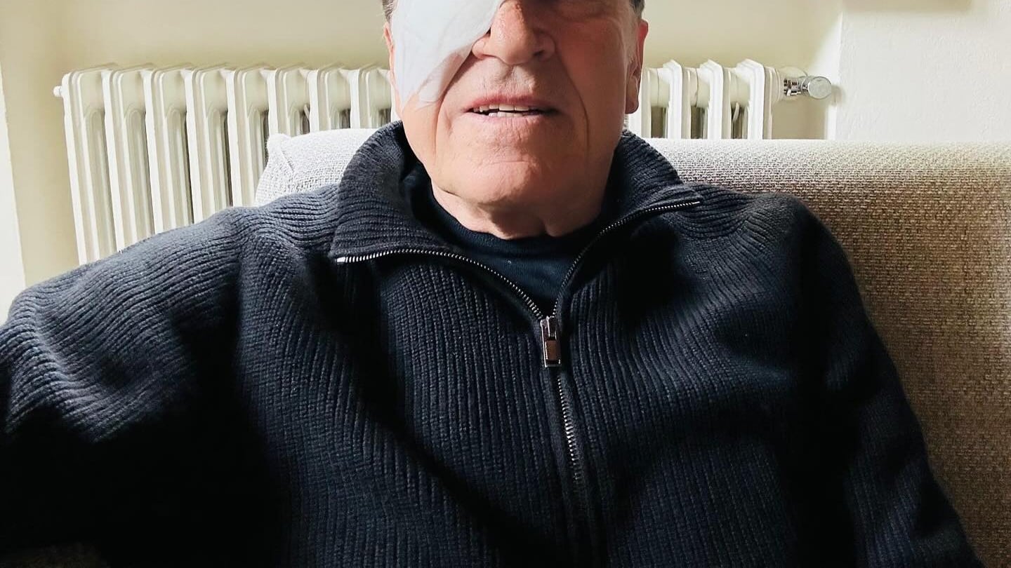 Gianni Morandi con un occhio bendato sui social. Paura per il cantante