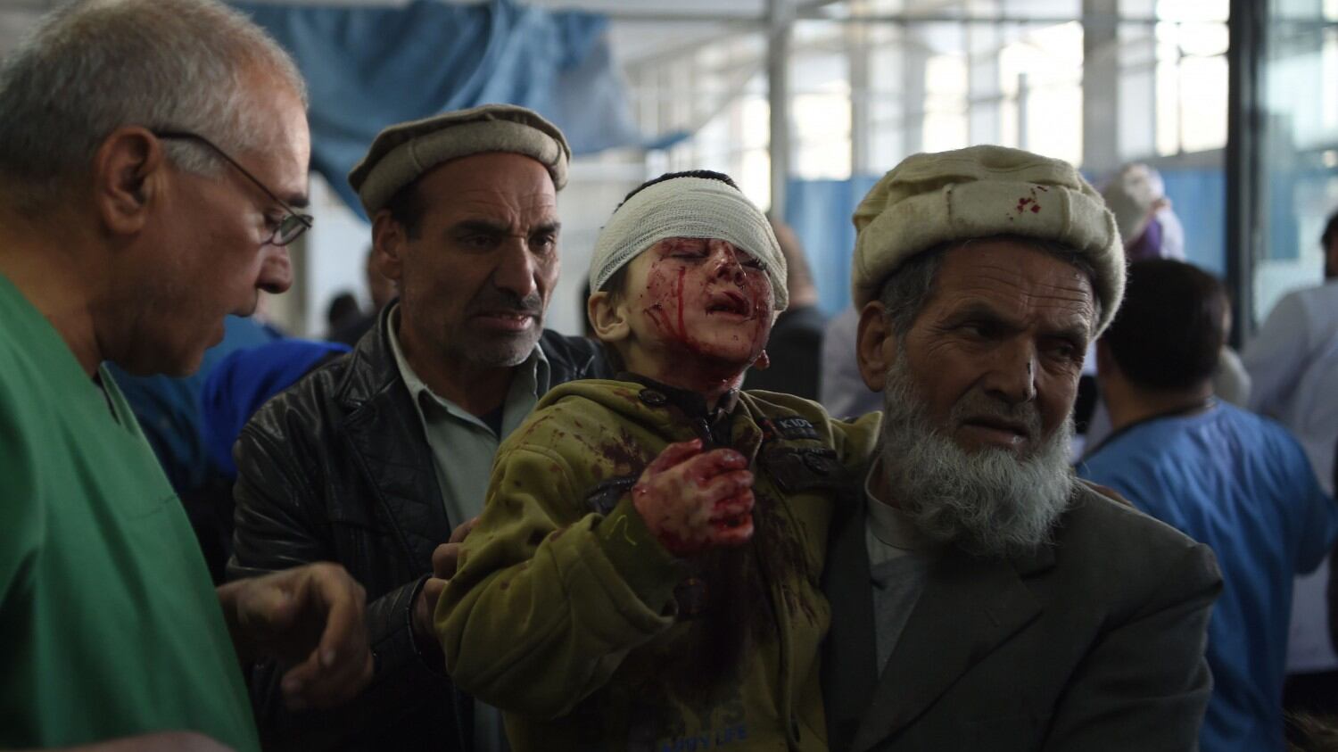 Kabul, una nuova esplosione: i talebani firmano il massacro