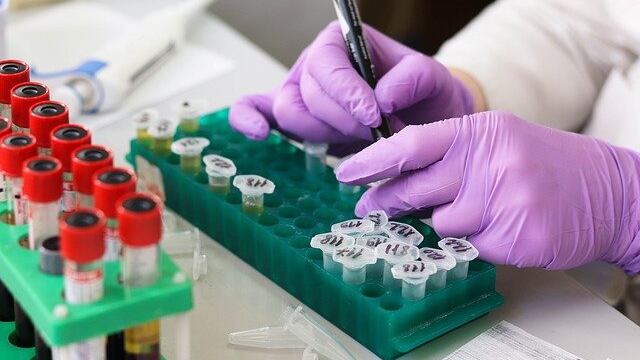 Tumore del colon-retto, l'importanza dello screening prima dei 50 anni