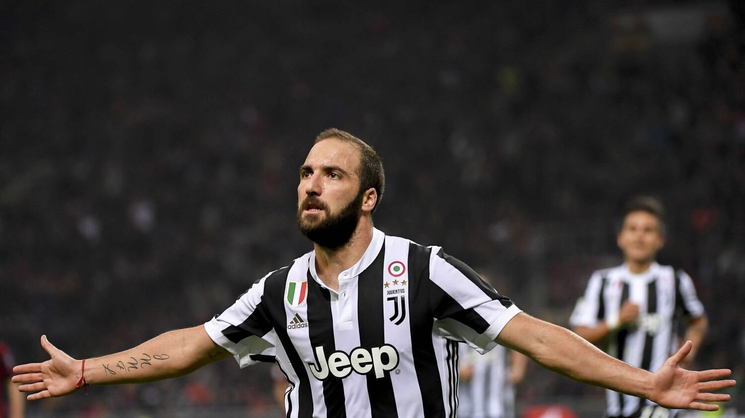 Higuain salta il Napoli: deve operarsi a una mano