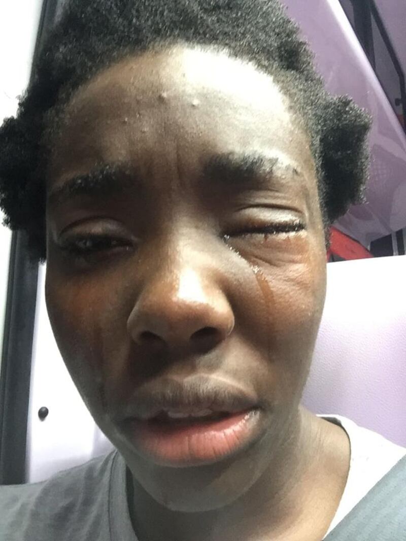 L'aggressione a Daisy Osakue, azzurra del lancio del peso 1
