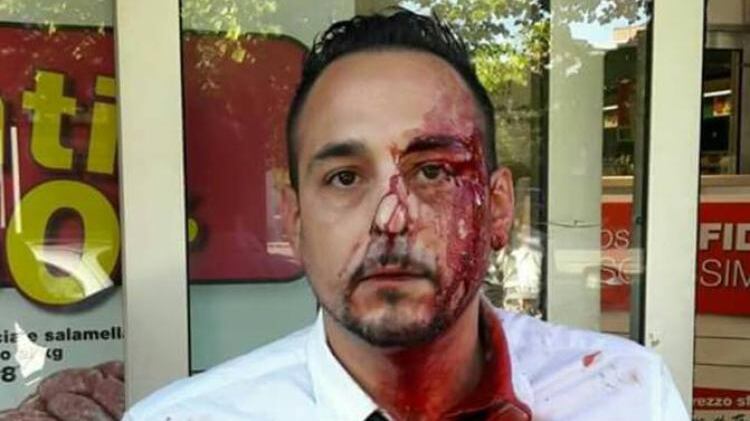 "Ho fermato un ladro romeno, mi ha rotto la bottiglia in faccia"