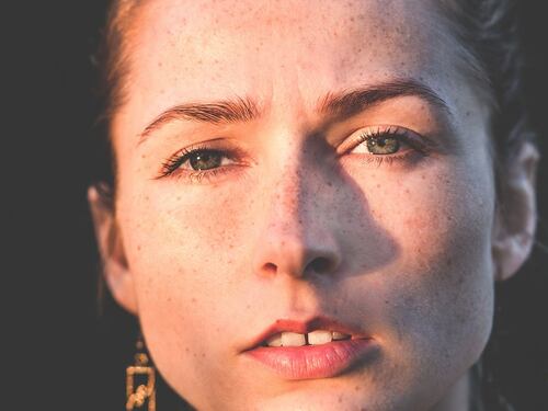 Psoriasi, che cos'è e come si cura