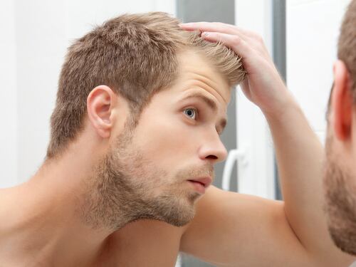 Il trapianto di capelli è definitivo? Tutto quello da sapere