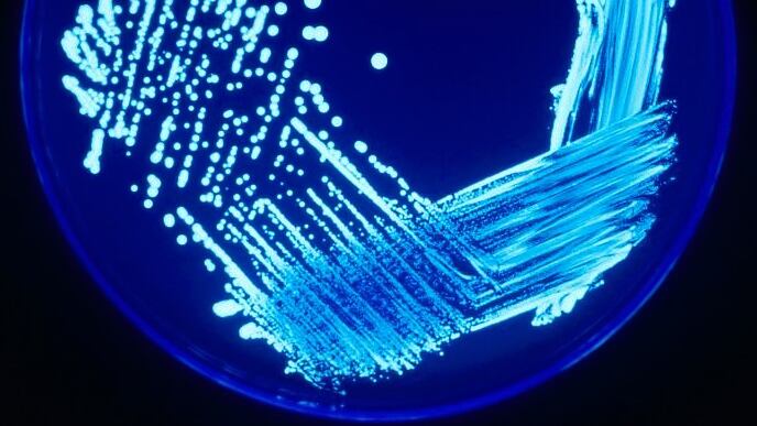 Allarme Legionella, a Milano un morto e casi in aumento: l'origine del focolaio