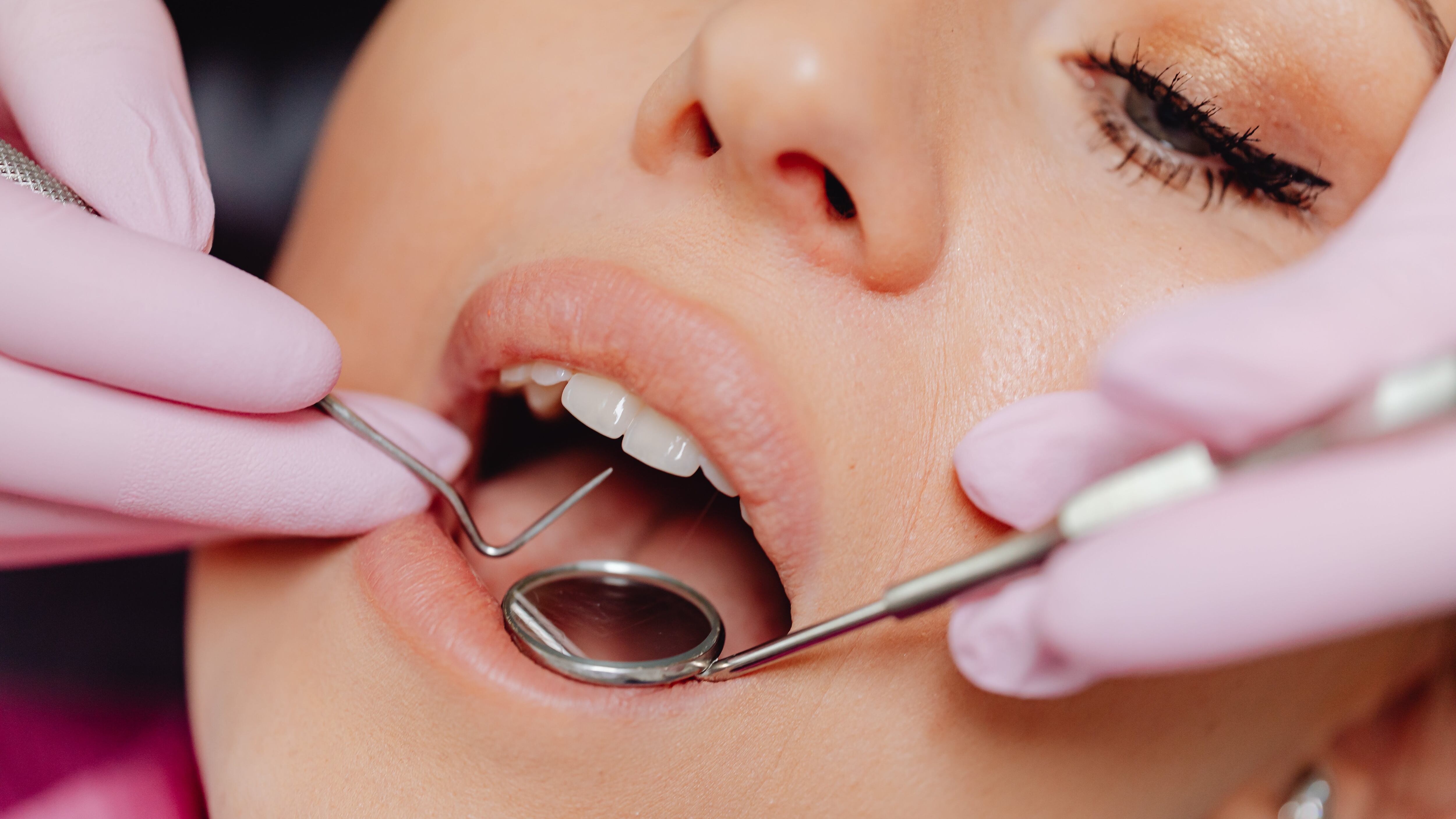 Malocclusione dentale: quali patologie pericolose può causare se si sottovaluta