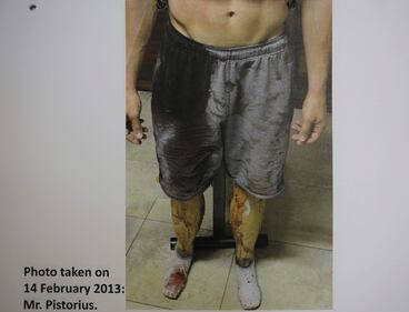 Pistorius, le foto dell'omicidio 9