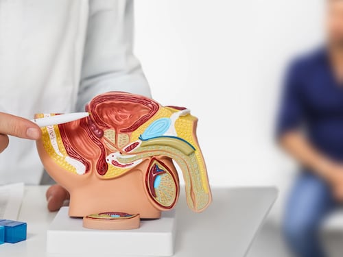Tumore prostata ad alto rischio recidiva, nuova terapia riduce del 58% rischio morte o metastasi