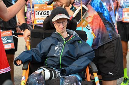 Sammy Basso, il più longevo malato di progenia 1