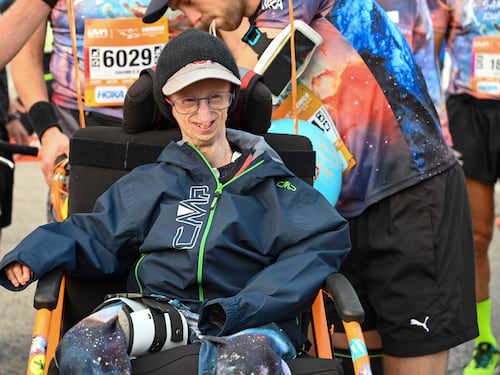 Sammy Basso, il più longevo malato di progenia