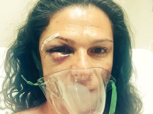 Senatrice cade dalla moto. E in quattro la pestano a sangue