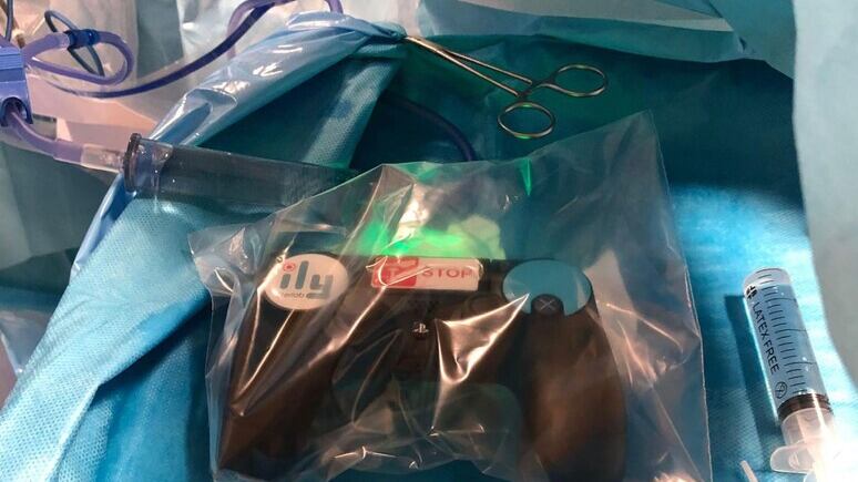 I calcoli renali? Operati con il joystick della PlayStation