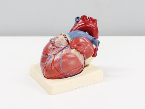 Cos'è il raro tumore al cuore di cui soffre Sofia Sacchitelli