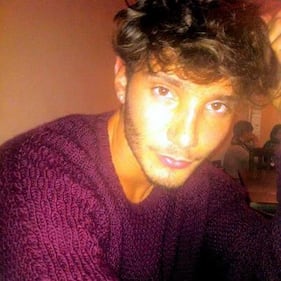Stefano De Martino cede al ritocchino: si è rifatto le orecchie 6