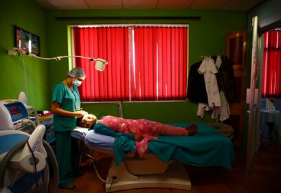 Nepal, soffrono di una malattia che li rende pelosissimi 3