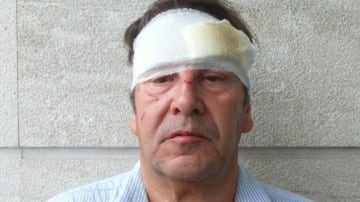 Picchiati brutalmente dai rom giornalista e operatore: "Volevamo solo aiutarli"