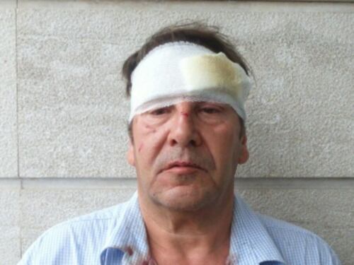 Picchiati brutalmente dai rom giornalista e operatore: "Volevamo solo aiutarli"