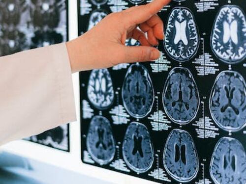 Egoisti o altruisti? Dipende (anche) dall’amigdala