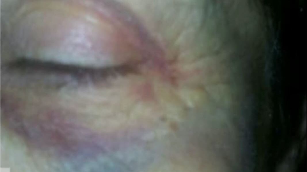 Arezzo, badanti maltrattano anziana invalida