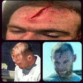 Rooney pubblica le foto del suo infortunio e sul web scatta la satira 2