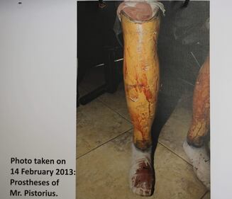 Pistorius, le foto dell'omicidio 10