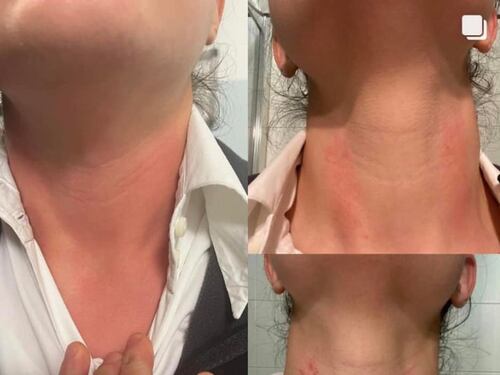 Dottoressa aggredita: "Pronta a lasciare il lavoro..."