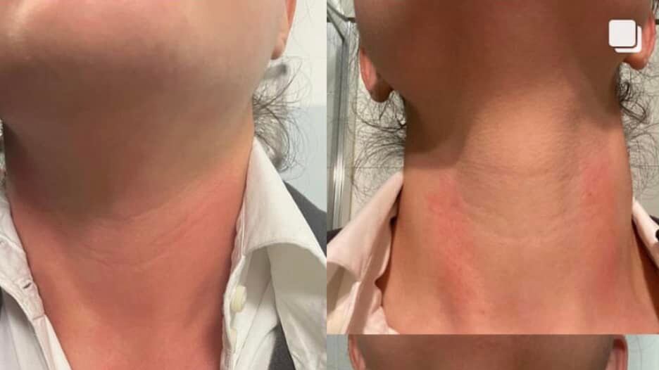 Dottoressa aggredita: "Pronta a lasciare il lavoro..."