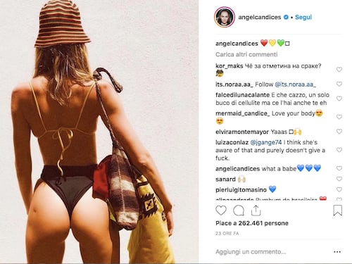 La curiosa cicatrice sul lato B di Candice Sweanepoel: "Vaccino in Africa"